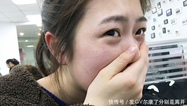 鼻子两侧挤出来的白色条状物，是什么？为何出现越挤越多的情况？