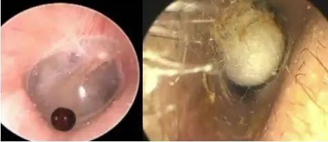 刮匙|儿子说“我是孙悟空”,妈妈一看当场吓懵!