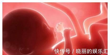 怀孕|胎儿“脐带绕颈”或许与妈妈这些行为有关,尽量避开