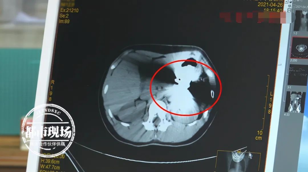 好奇|充满好奇,12岁男孩竟把它给吃了