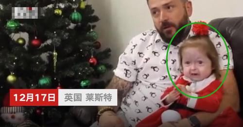 全球首例！2岁女童却有80岁的脸，网友：希望能像本杰明巴顿一样