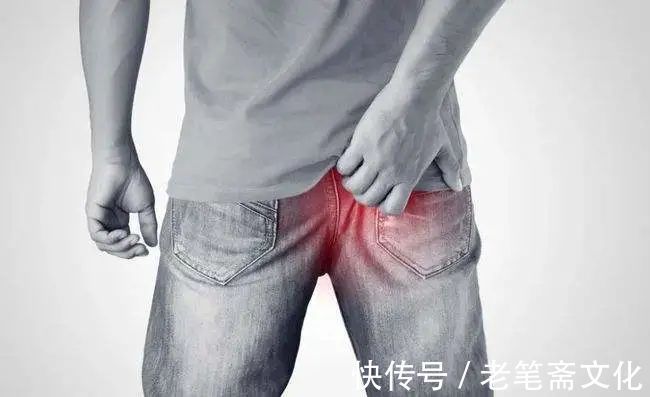 止痛|痔疮久治不愈怎么办?不开刀不塞药,患者亲测快速消除顽固痔疮!