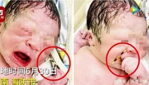 不易|女子避孕2年仍然怀孕，男宝出生时手里抓着东西曝光，活着不易