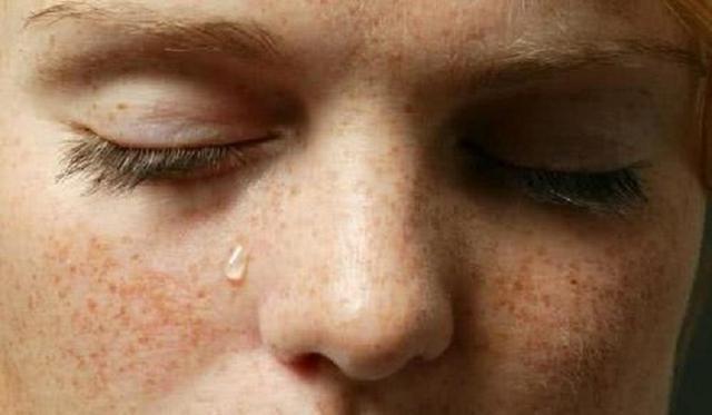 黑眼圈|女性脸部有4个“症状”别马虎，可能得了妇科病，要足够重视