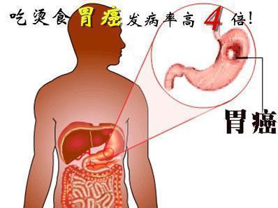 胃病|胃开始癌变,身体会出现“3多2臭”,若1个没占,胃部还算健康