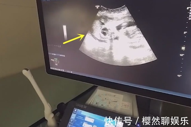 父母|男孩哭着求妈妈留下二胎,每逢产检必到场,过目检查结果后才放心
