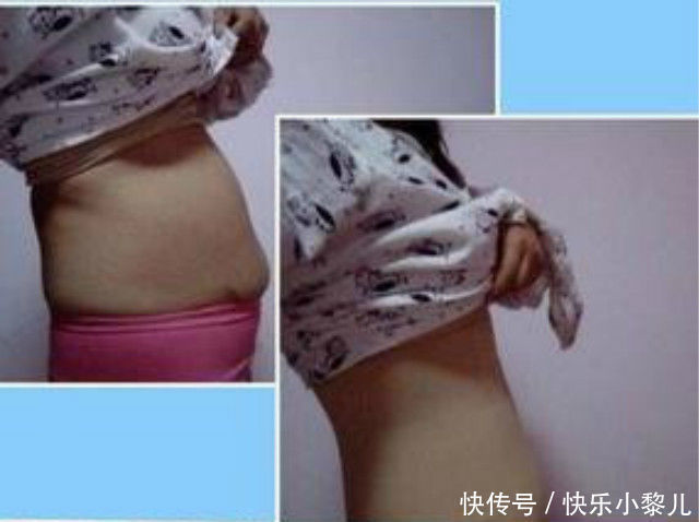 腹直肌|产后受损的三个重要部位,产妇一定要及时修复,别等老了再后悔