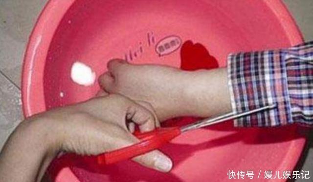 家长|孩子被烫伤,是该先脱衣服还是先冲水?一步做错,孩子伤情更严重