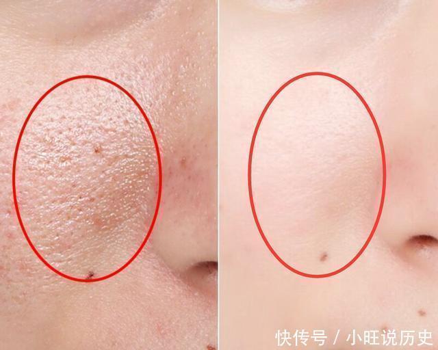 大多女性都“看不起”超市里1元钱的它,睡前擦点,取代玻尿酸