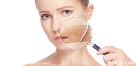 月经紊乱|女人雌性激素低,一般会有五个表现!女人味还算可以