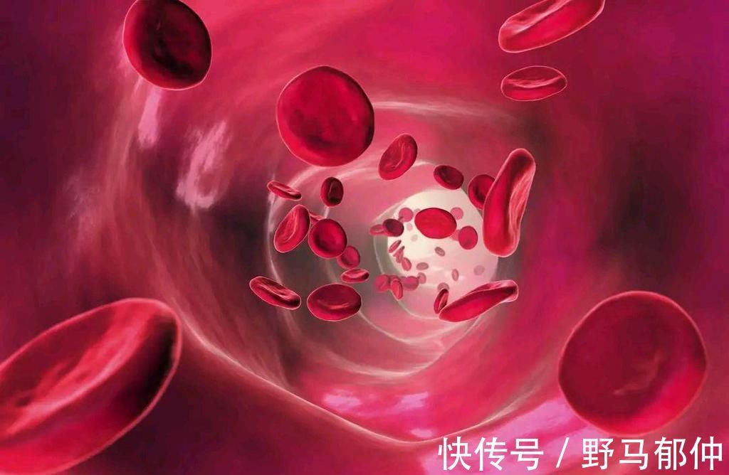 鸡蛋|血脂偏高的人，每天吃鸡蛋会加速血管堵塞吗？鸡蛋能不能天天吃？