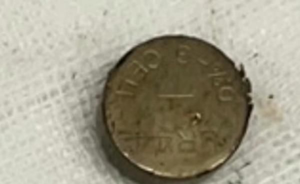 家长|男童好奇误吞纽扣电池后送医，家长觉得没大碍直接抱回家