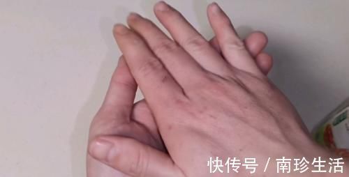 赶紧把白醋倒在手心搓一搓，真的太厉害了，活了20年才知道！