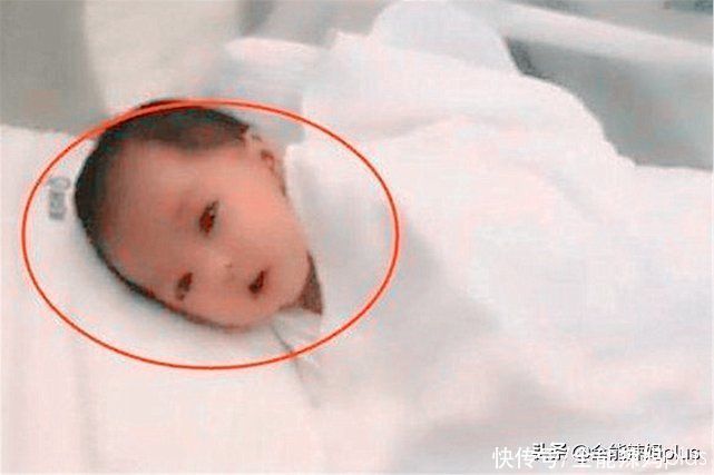 宝宝|“最漂亮婴儿”火了,颜值惊艳整个产房,医生:我也第一次见