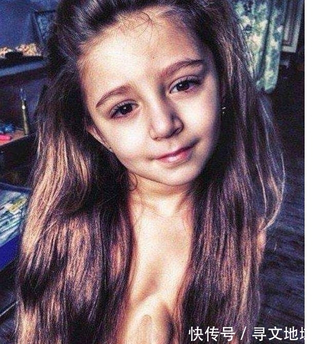 医生|女童心脏长在胸腔外,医生断言活不久,如今已6岁长得特别漂亮