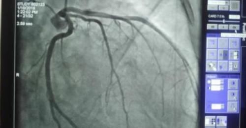 心肌$达芬奇曾画出心脏细微结构图,如今专家分析25万张图像才找到