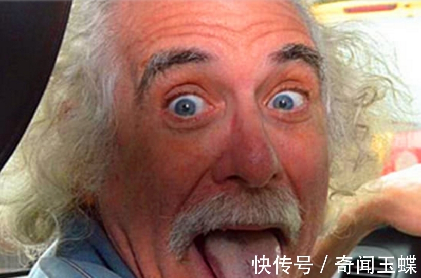 头发|世界上最奇怪的病，患者不能梳头，全球仅有百例，爱因斯坦是其一