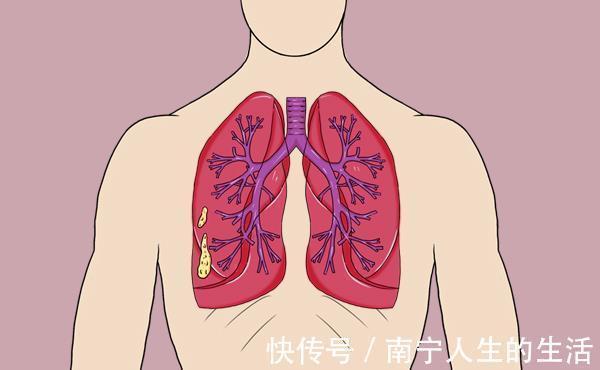 盗汗|睡醒后满身是汗?多半是阴虚盗汗,中医生教你3种调理方法