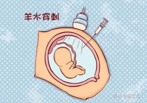 检查|高危产妇需做哪些检查？导致孕前孕后高危的因素是什么？