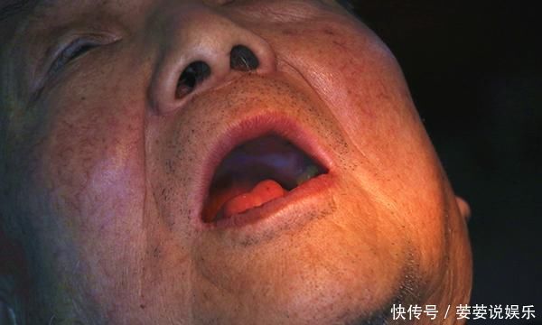 口腔癌是怎么回事医生坦言一旦出现3个信号,尽快做检查