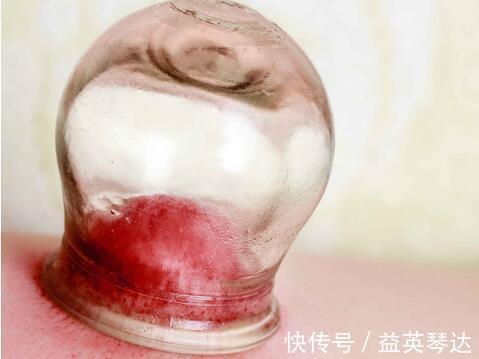 湿气|没有丑女人,只有脾虚女 ,脾虚易衰老,补脾学会5招