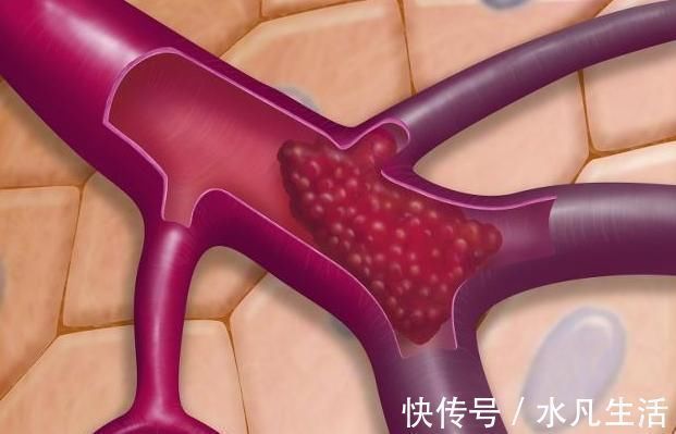 番茄|天然血管“清道夫”找到了,经常吃,清血管降血脂,血栓不敢扰!