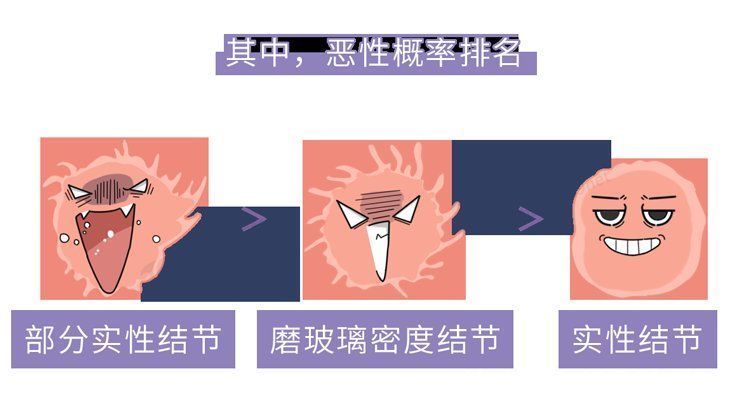 恶性|磨玻璃肺结节是肺癌吗？恶性不取决于大小，这2种尤其要当心