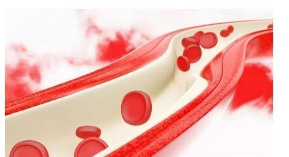 清洁工|血管“清洁工”找到了!不是大蒜,若每天吃一点,血脂悄悄降