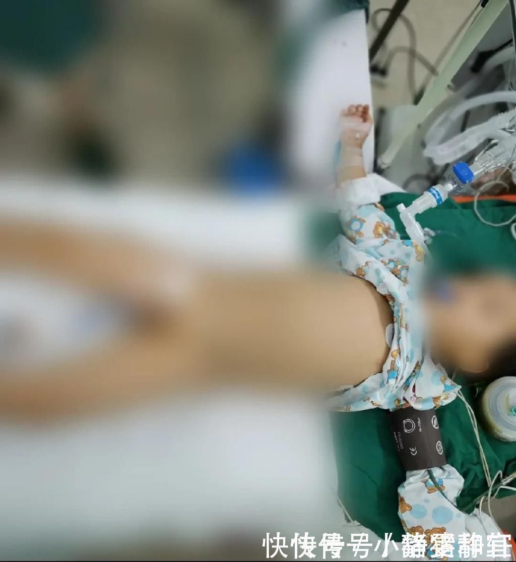 动作|家长们注意了4岁男孩饭后做了这个动作,150厘米小肠被切除……