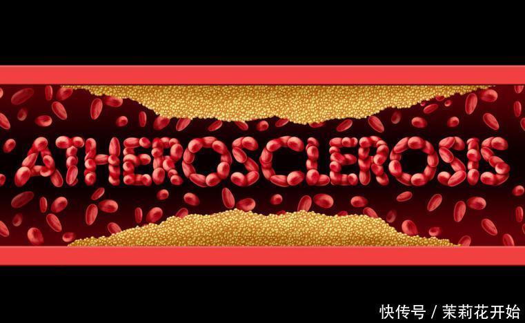 饮食|38岁男子,甘油三酯从58降到15,他说平常吃“一果”的功劳很大