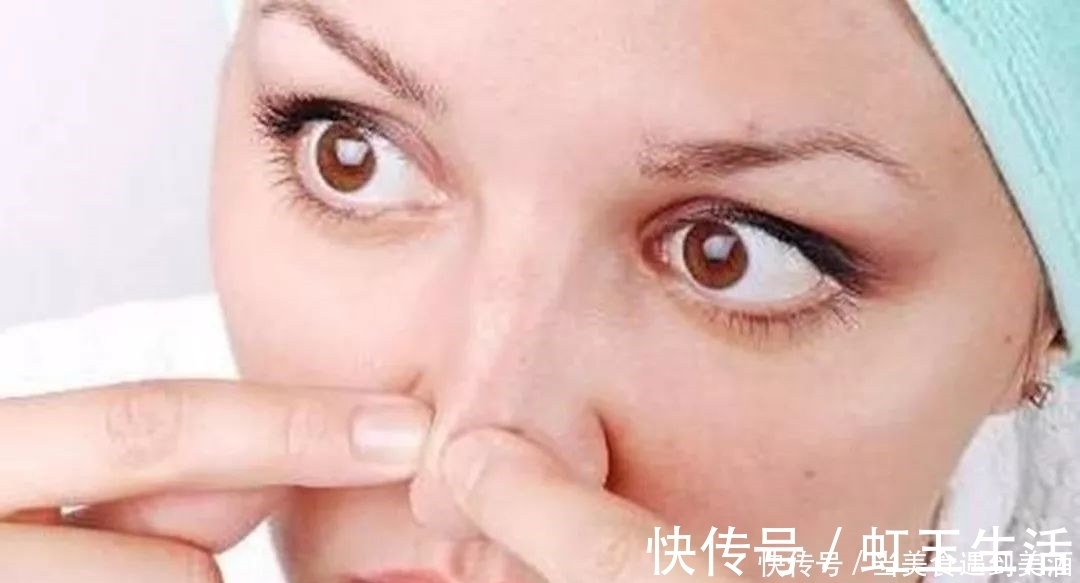 草莓鼻|女生几个坏习惯,会使你的鼻子越来越丑!草莓鼻都是轻的