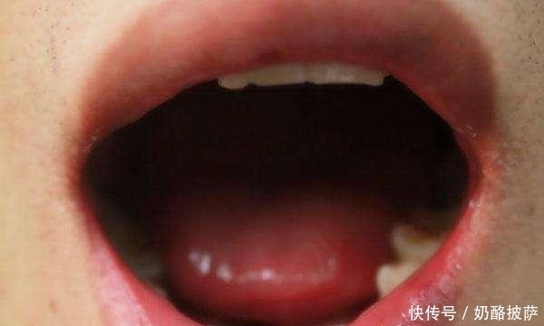  颜色发|提醒：如果你的舌头是3种颜色，要当心，很可能是健康出了问题