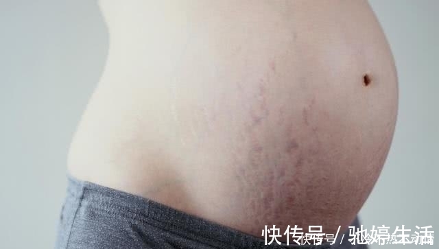 肚子|怀孕期间,必须要注意的几种情况,否则很容易让肚子“变丑”
