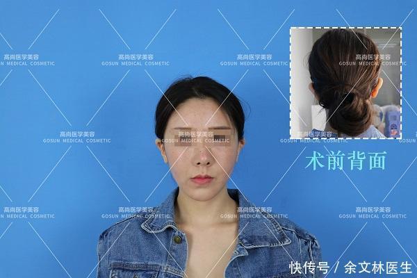 正面照相看不到耳朵