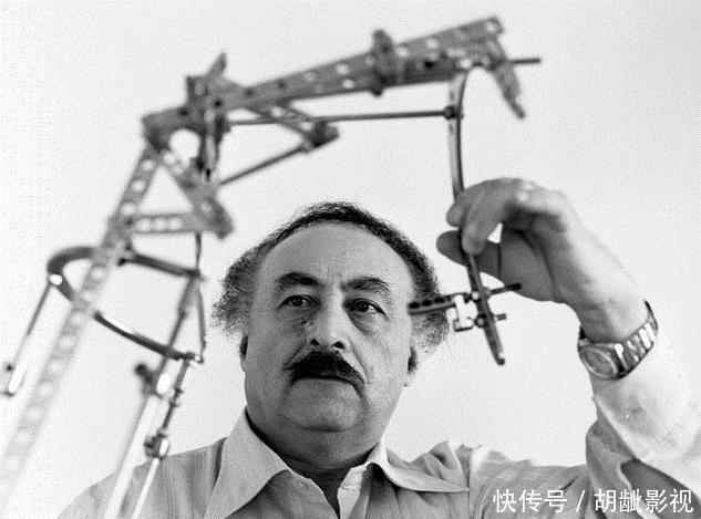 当年因身高矮自卑,花16万断骨增高72厘米的李亚诺,后来怎样