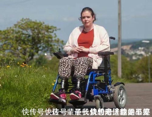 小宝宝|生下孩子醒来却发现自己的腿不见了!这是什么操作!