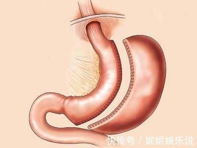 一个民间土方子,香油炸下鲜姜片,10年老胃病,7天就见效!