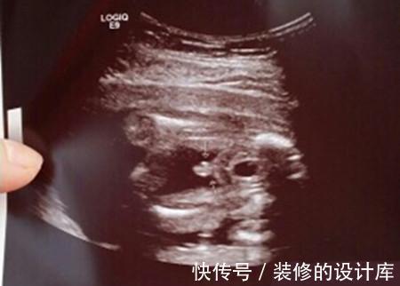 欧阳|求锦鲤、望翻盘,想生男孩的她们有多努力?