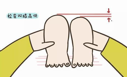 宝宝皮纹不对称是正常的吗