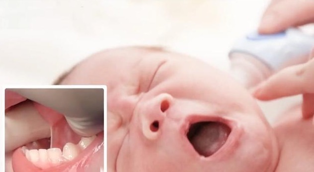 睫毛|宝宝1岁还不会说话,爷爷怀疑没剪舌根,医生回去吧治不了