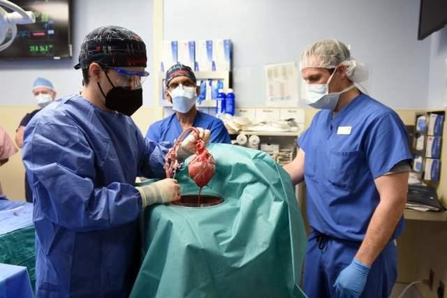 病人|美国医生首次将猪心脏移植病人体内，3天后患者情况良好