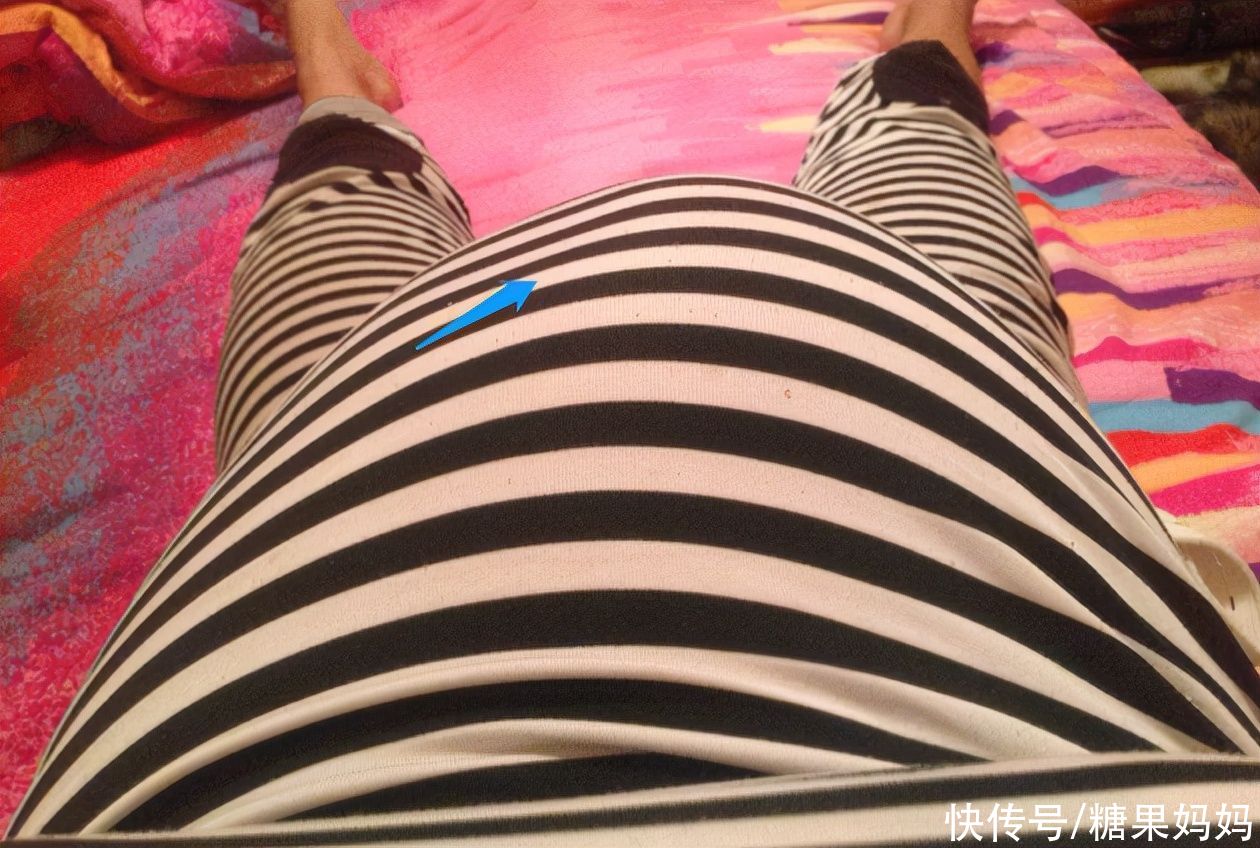 吴女士|孕肚只有右侧比较硬，是因为怀了女宝？准妈妈需了解真实原因