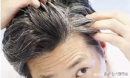你的白发代表什么?后脑白发为肾气不足,