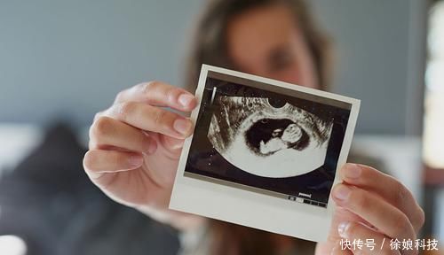 池川明|胎儿有宫内记忆？爸爸：4岁儿子的话让我流泪，早知应更重视胎教