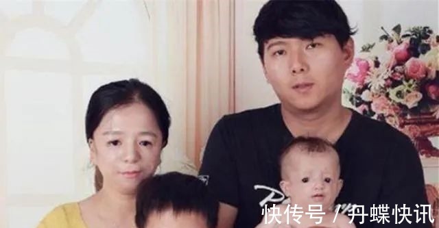 二胎|“鸟脸”妈妈执意生二胎,孩子不幸被遗传,一时的冲动毁孩子一生