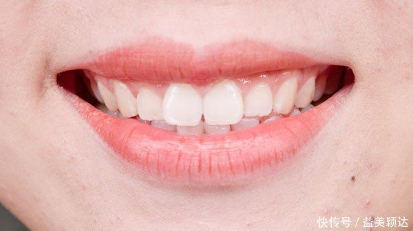 脾虚|你的脾虚不虚,看脸就知道健脾只需一个小方子