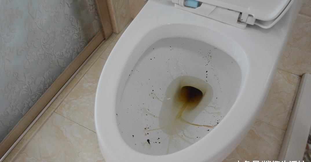 小苏打|不管马桶多黄多脏, 只需倒一碗它进去, 马桶一冲立马变干净