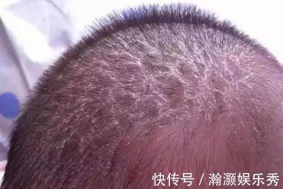 带娃|妈妈偷懒的带娃方式,差点把2个月宝宝差点弄成脑瘫,医生:无知