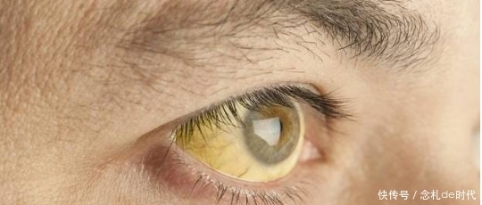 “肝”不好的人,嘴巴和眼睛可能会有几种变化,请不要忽视