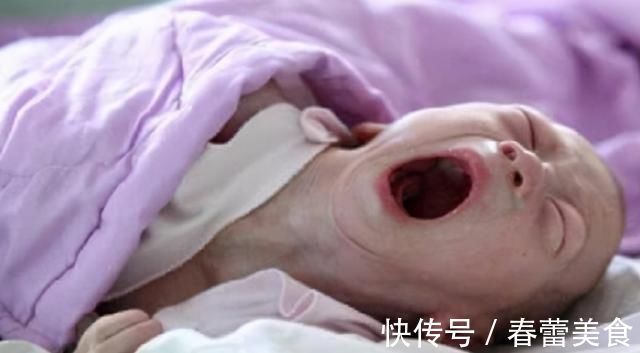 畸形儿|四维检查宝宝畸形,孕妈却执意生下孩子,出生后全家“沸腾了”